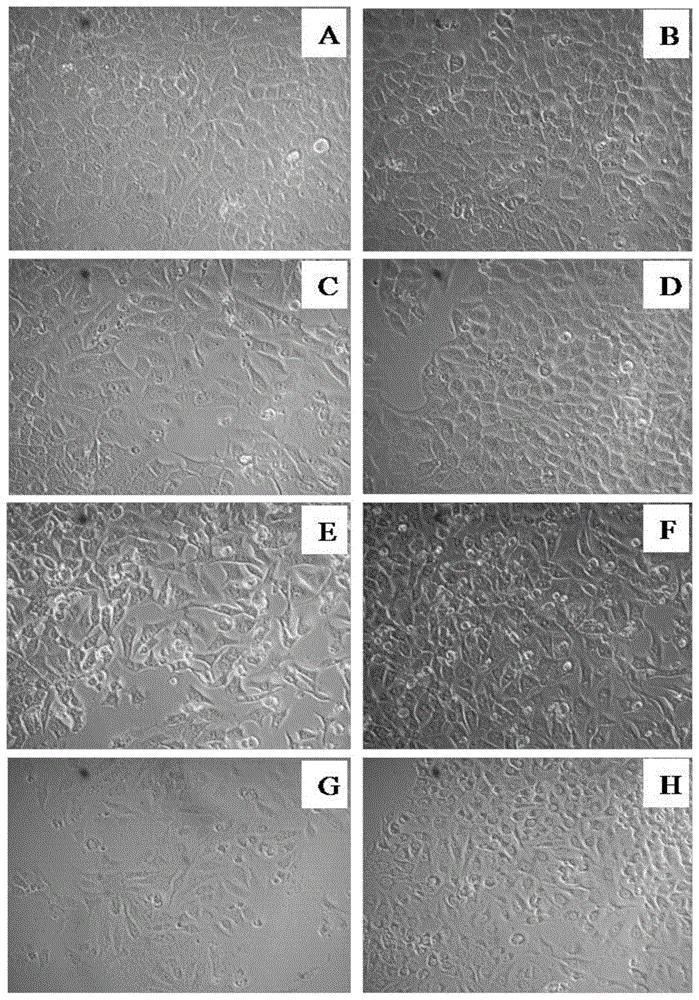 杂环苦参碱衍生物及其制备方法和应用