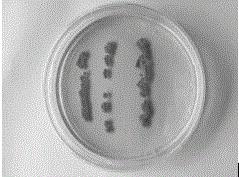 一种具有强烈抑菌作用的链霉菌A2菌株及其应用